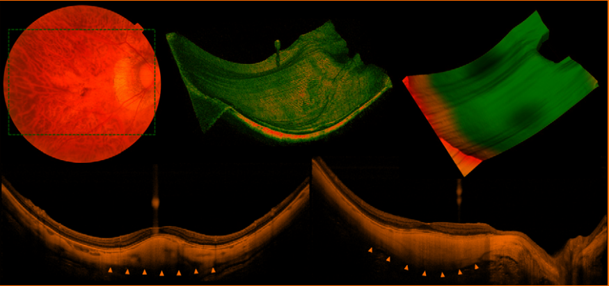 1663772149389-282cd1a2-9948-4c77-9cf5-aaf5f9b9a93b.png