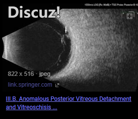 1662219813529-da78dca9-2ca8-4e65-b100-9b8f16b9f1eb.png